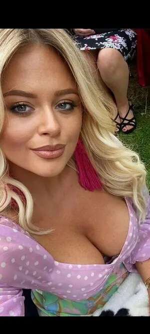 Emily Atack