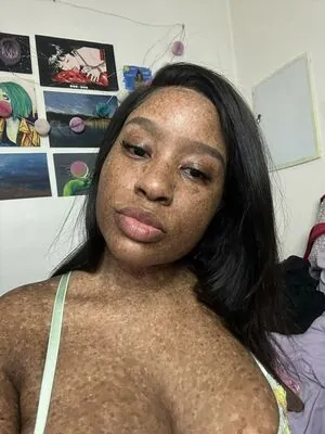 freckledn content