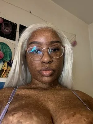 freckledn content
