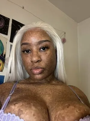 freckledn content
