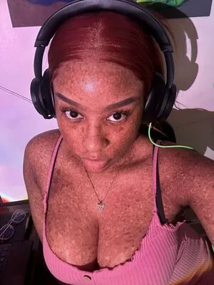 freckledn content
