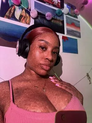 freckledn content