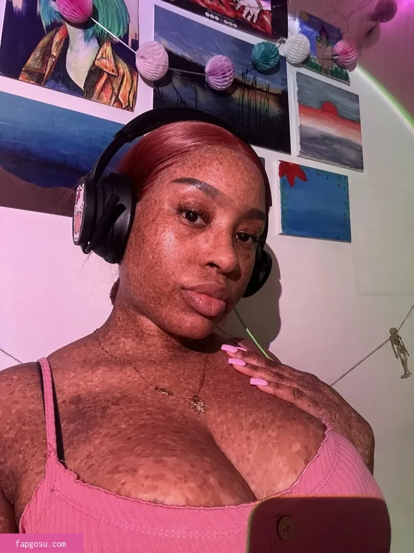freckledn