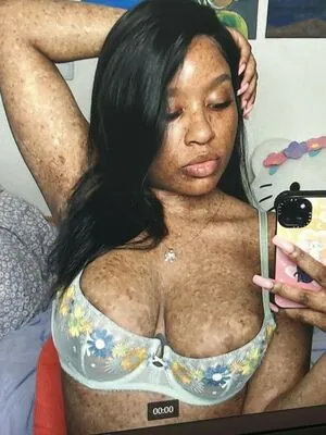 freckledn content