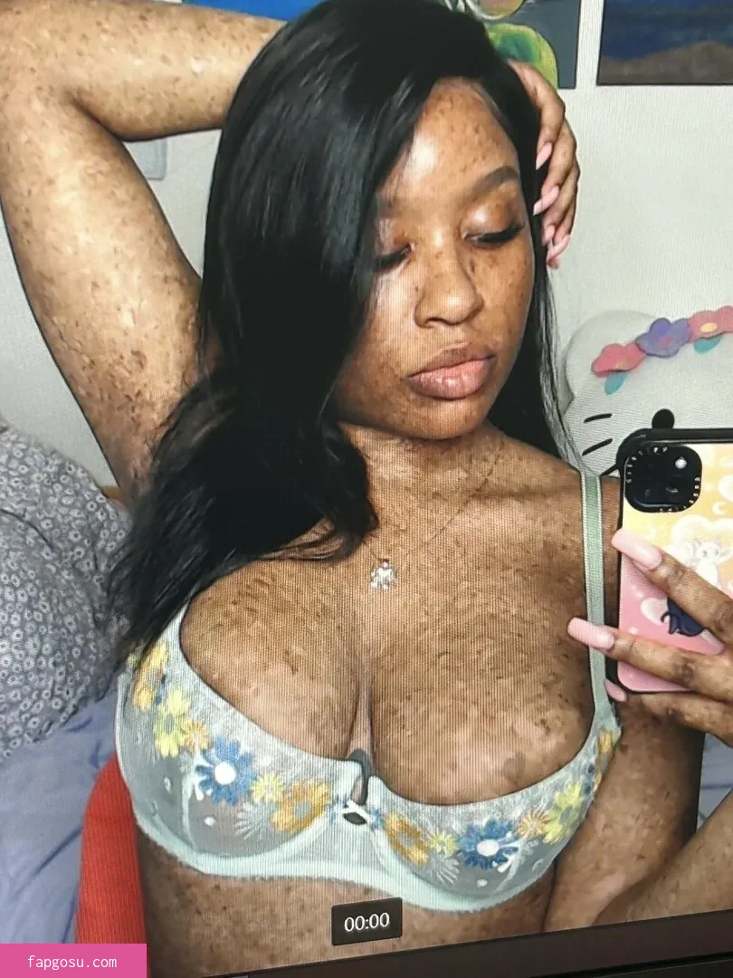 freckledn