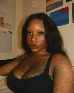 freckledn content