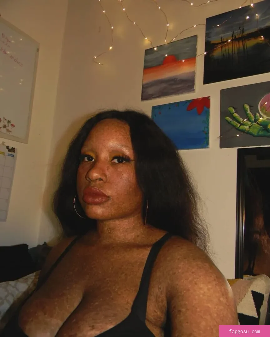 freckledn