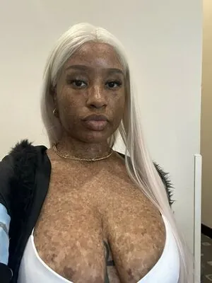 freckledn content