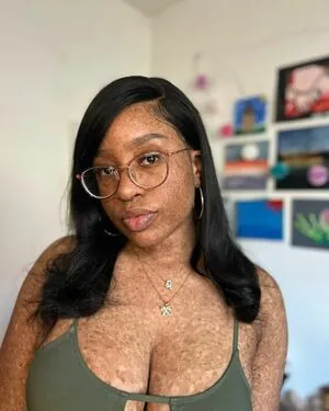 freckledn content