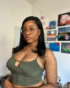 freckledn content