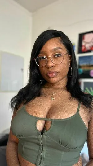 freckledn content