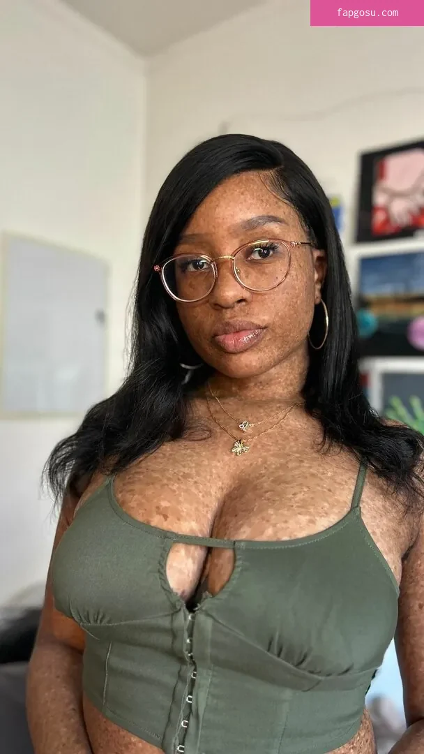 freckledn