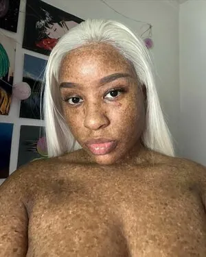 freckledn content