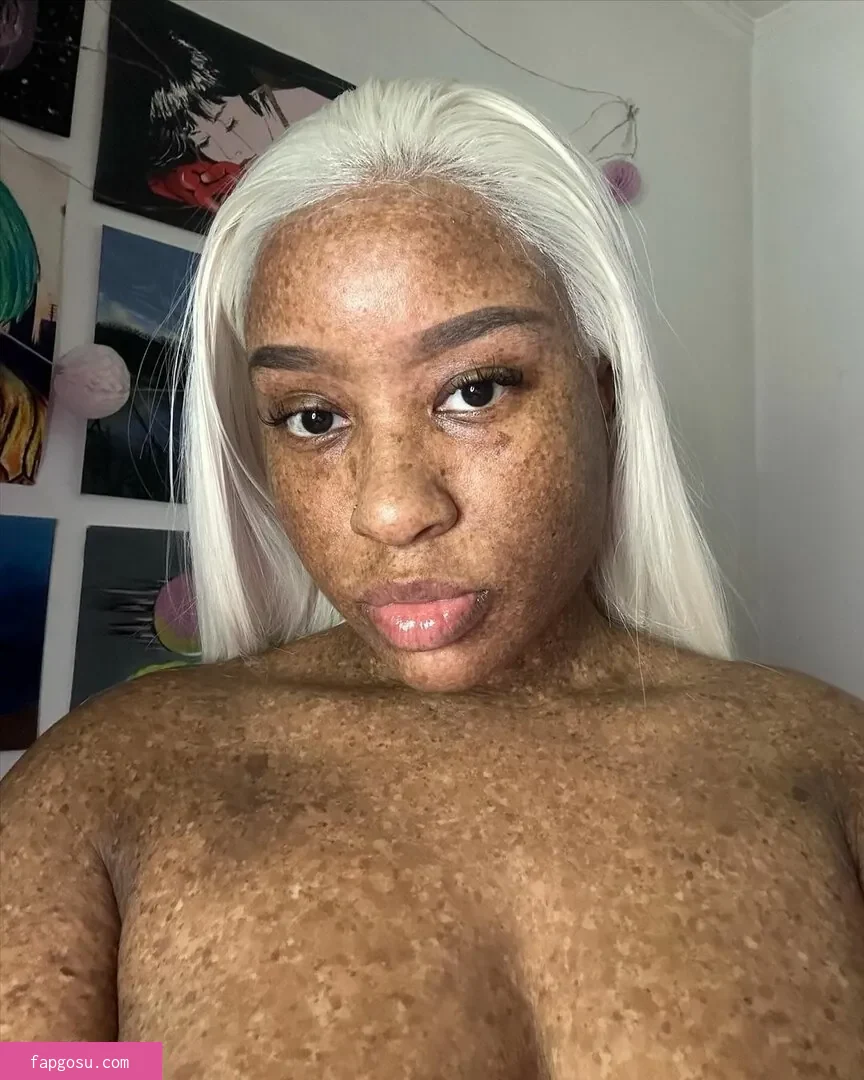 freckledn