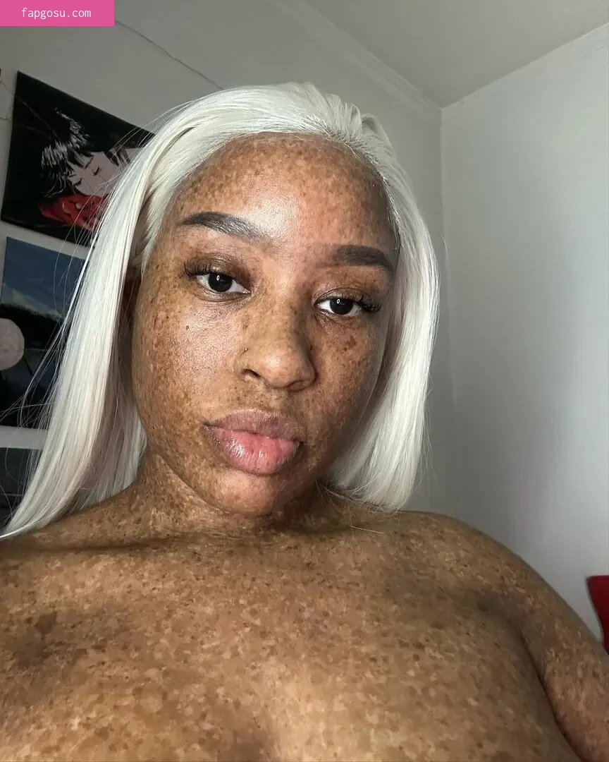 freckledn