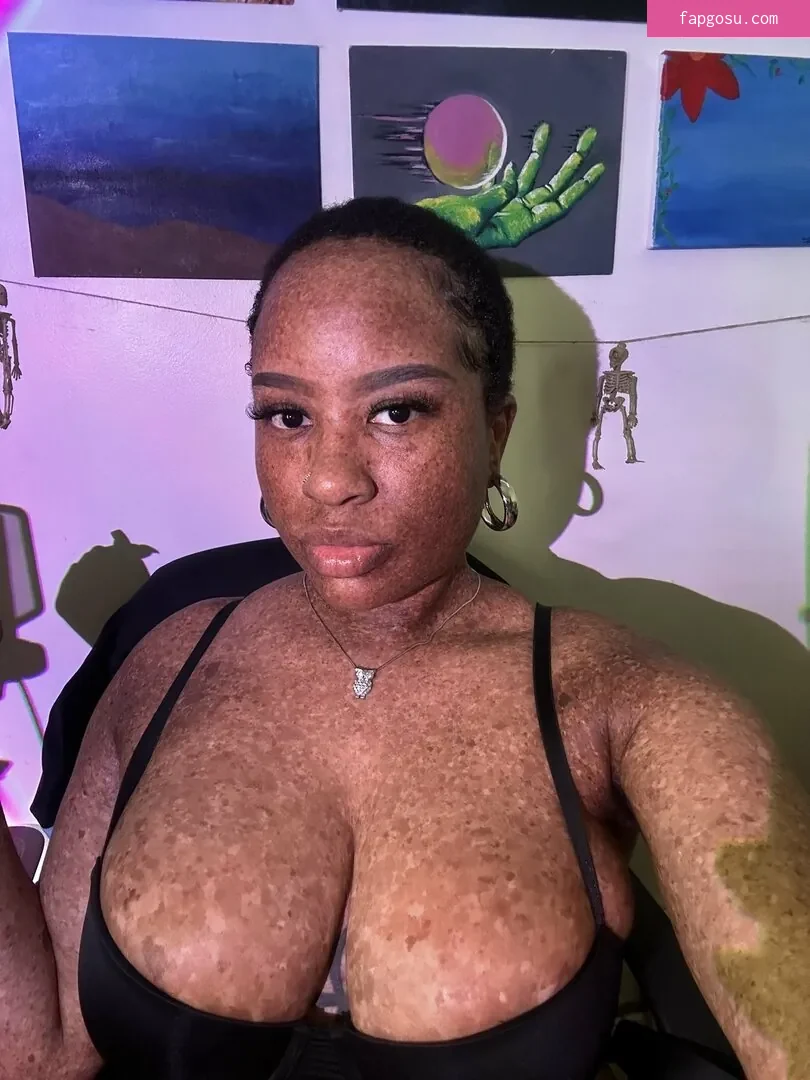freckledn