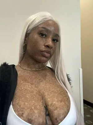 freckledn content