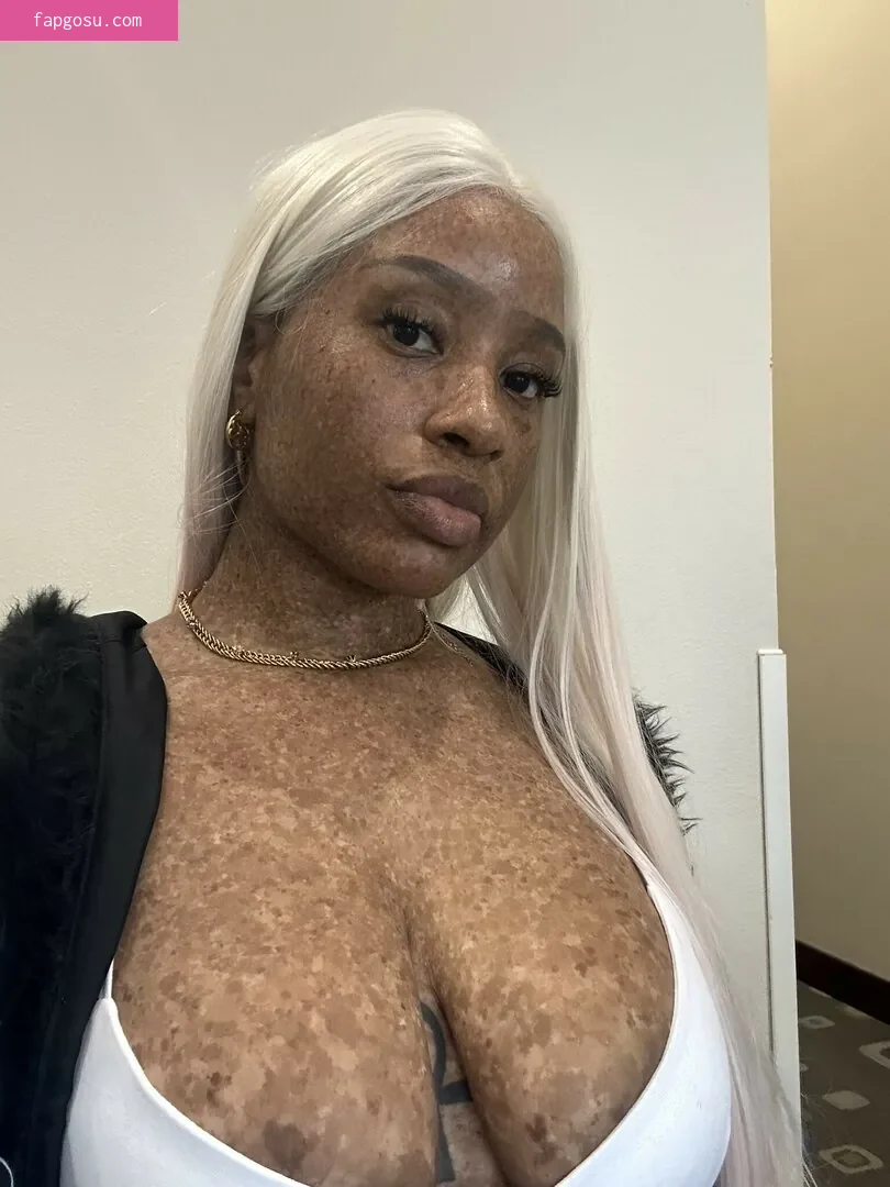 freckledn