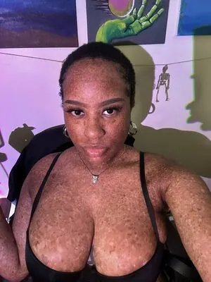 freckledn content