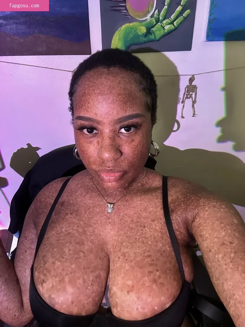 freckledn