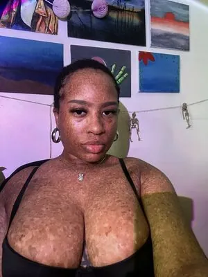 freckledn content