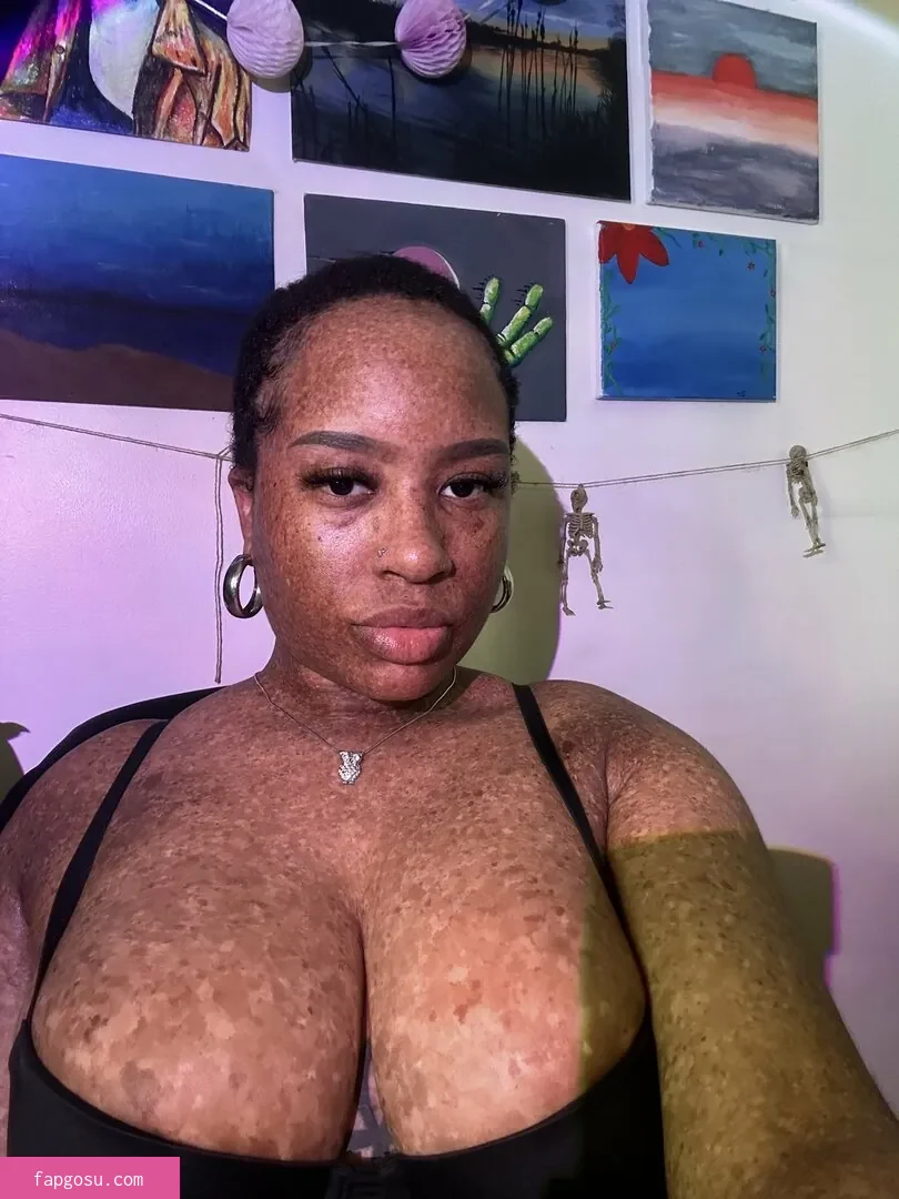 freckledn