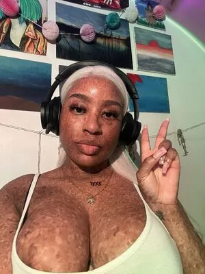 freckledn content
