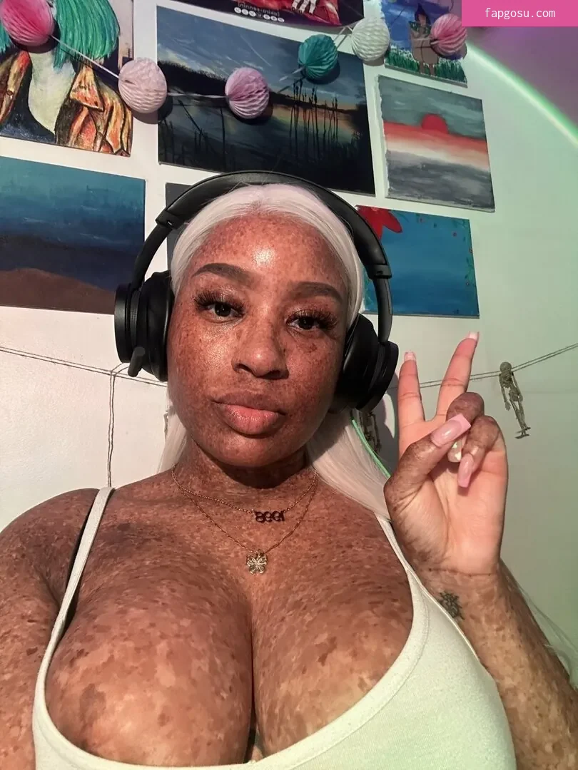 freckledn