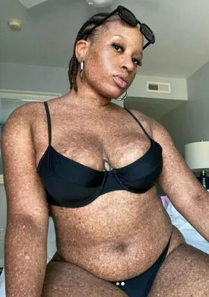freckledn content