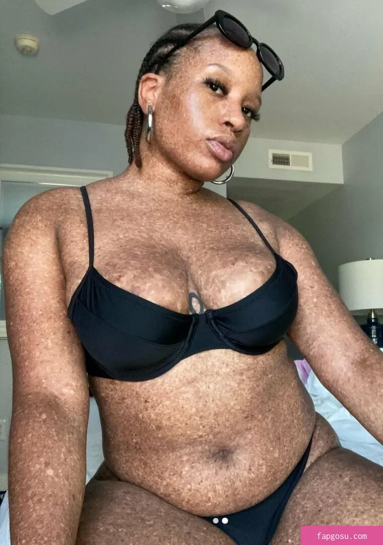 freckledn