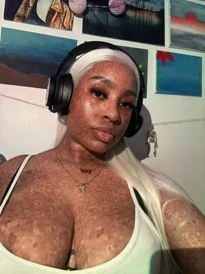 freckledn content