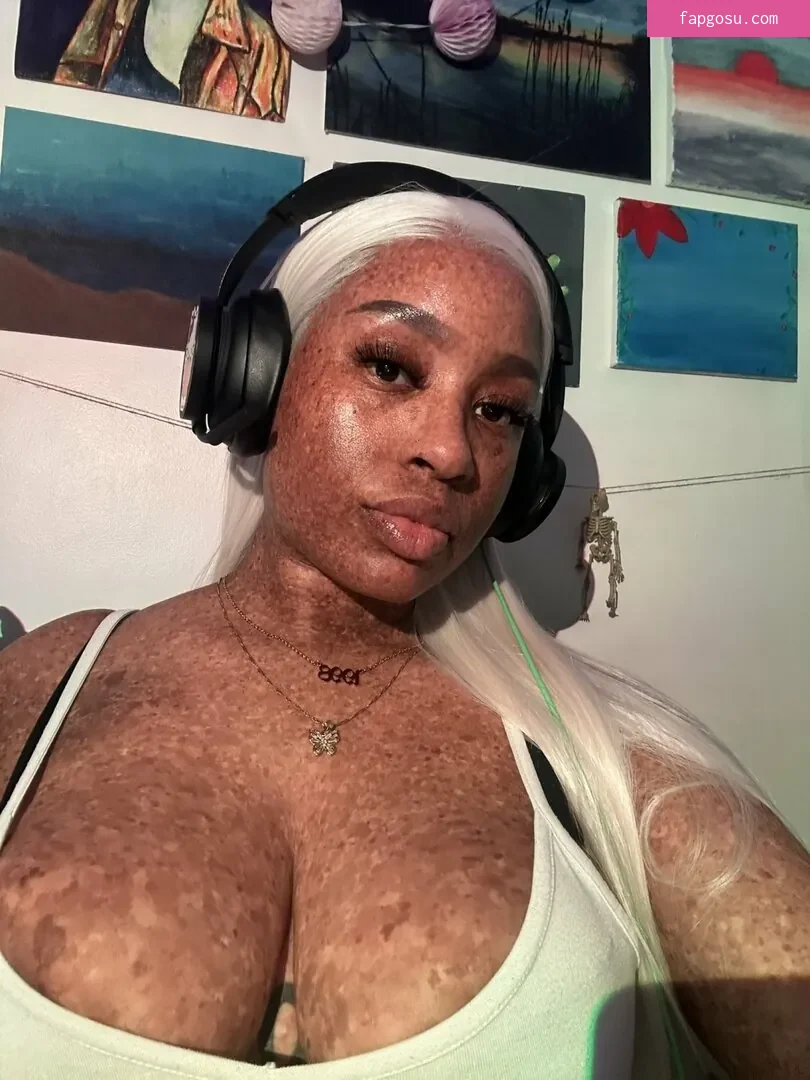 freckledn