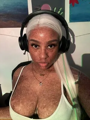 freckledn content