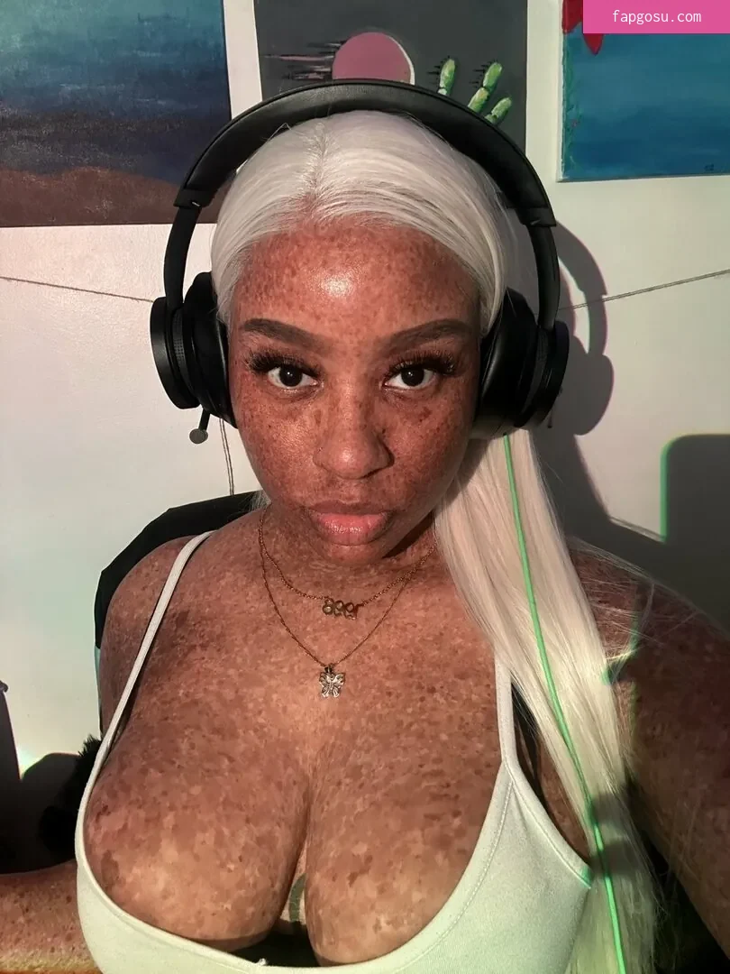 freckledn