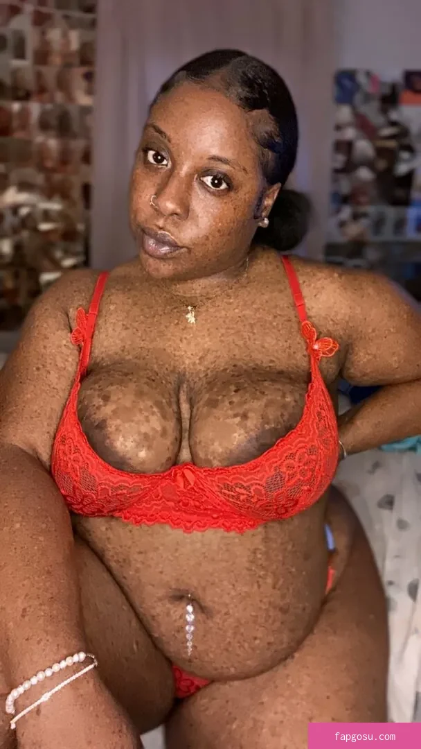 freckledn