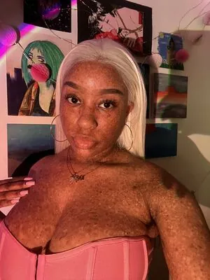 freckledn content