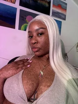 freckledn content