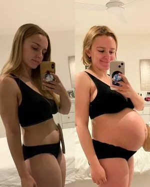 Hannah Witton aka Hannahwitton Nude Leaked OnlyFans - Fapgosu