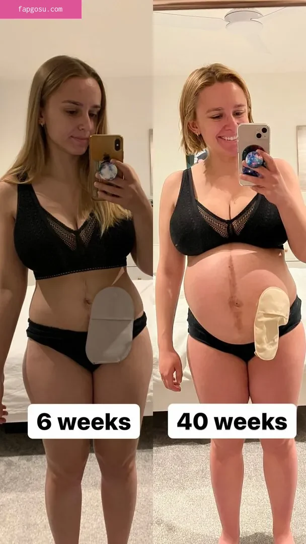 Hannah Witton