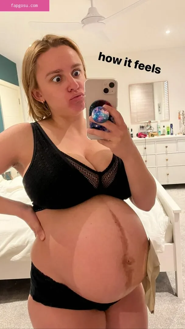 Hannah Witton