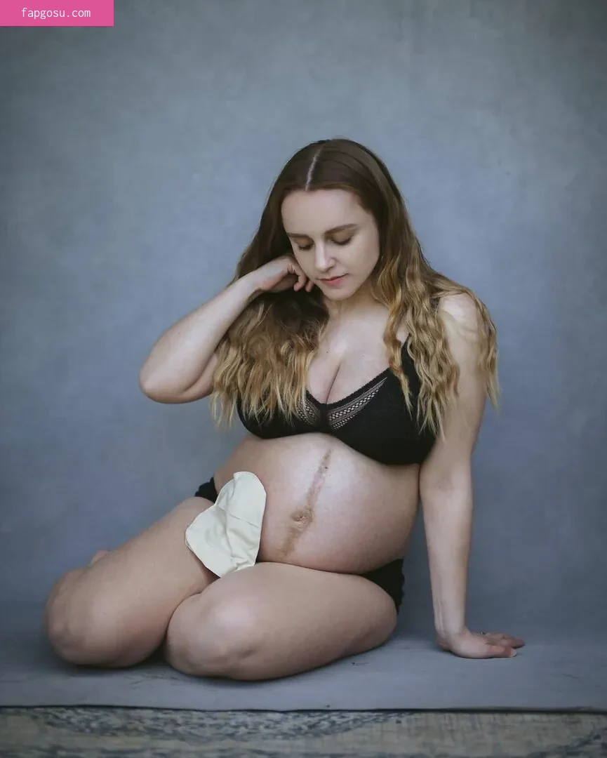 Hannah Witton
