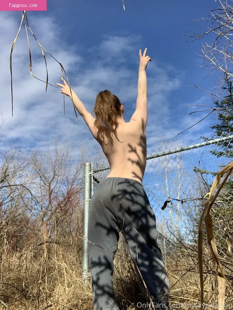 myskyewatson