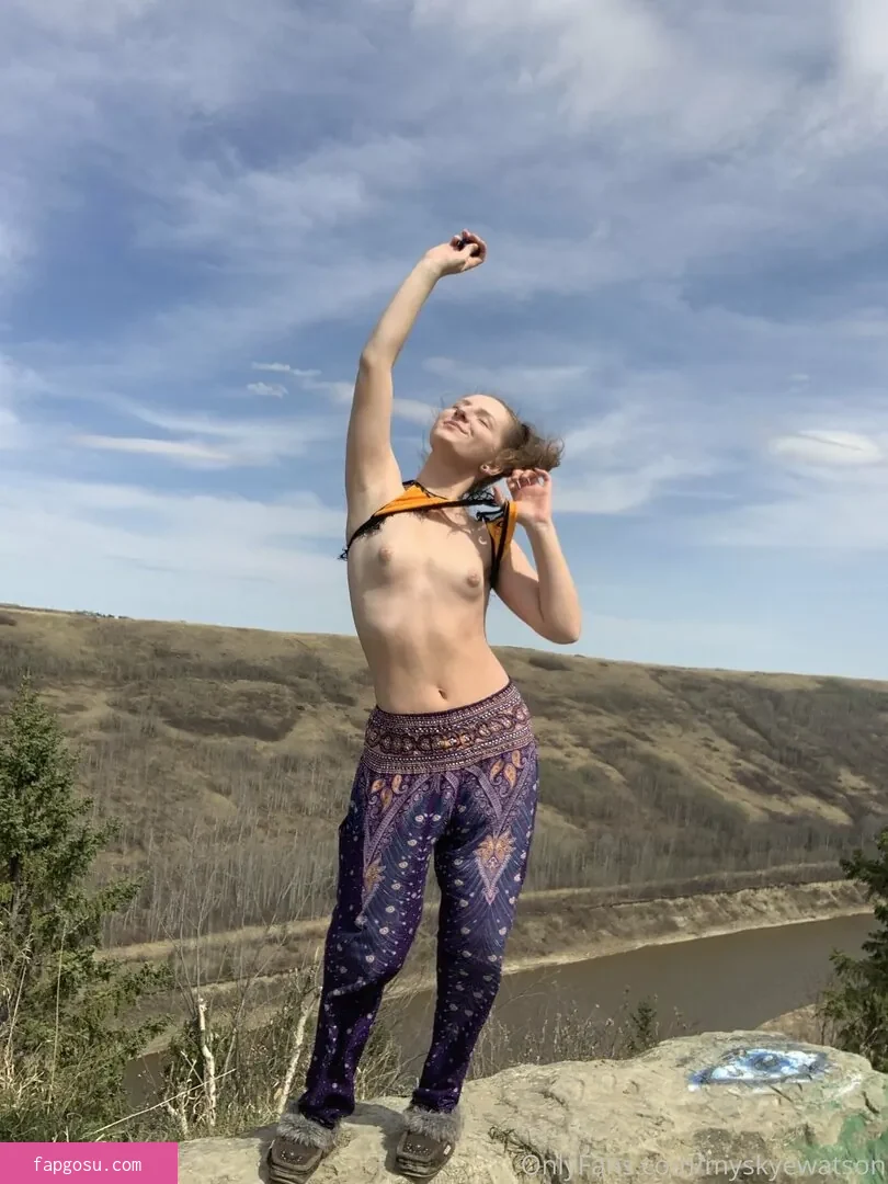 myskyewatson