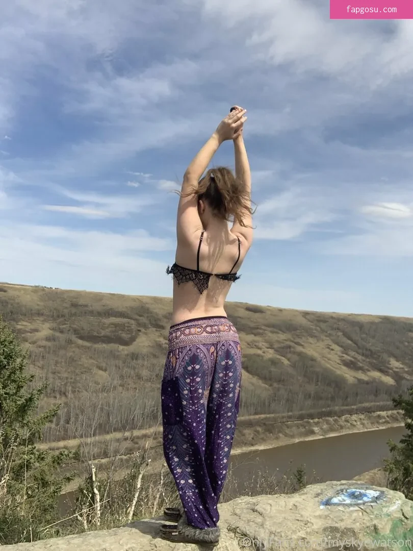 myskyewatson
