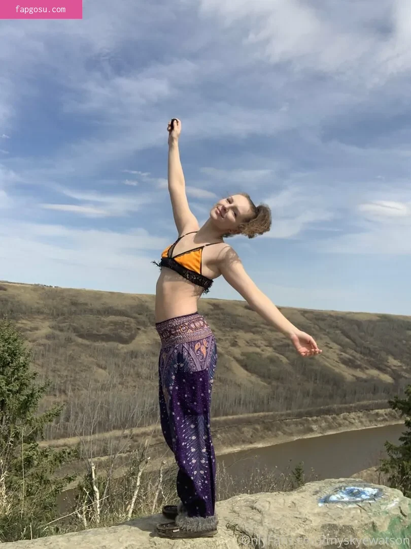 myskyewatson