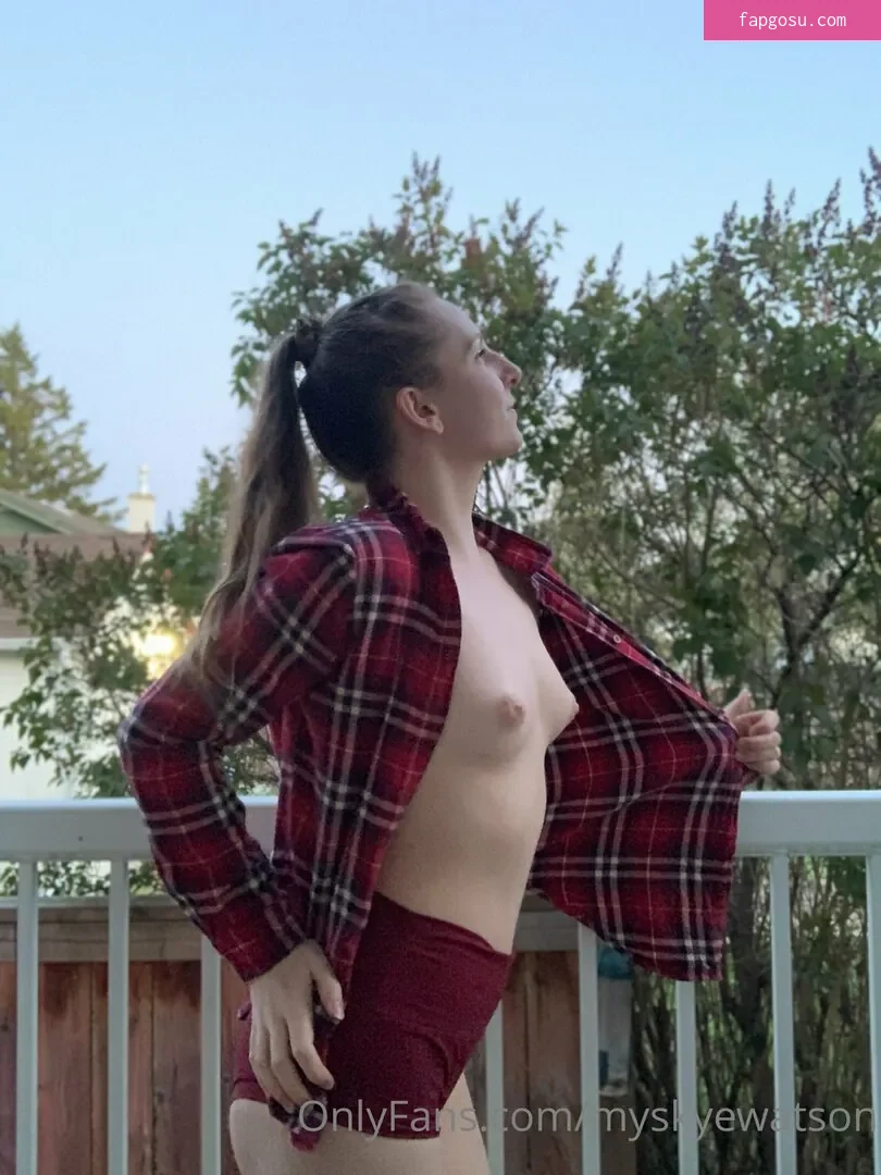 myskyewatson