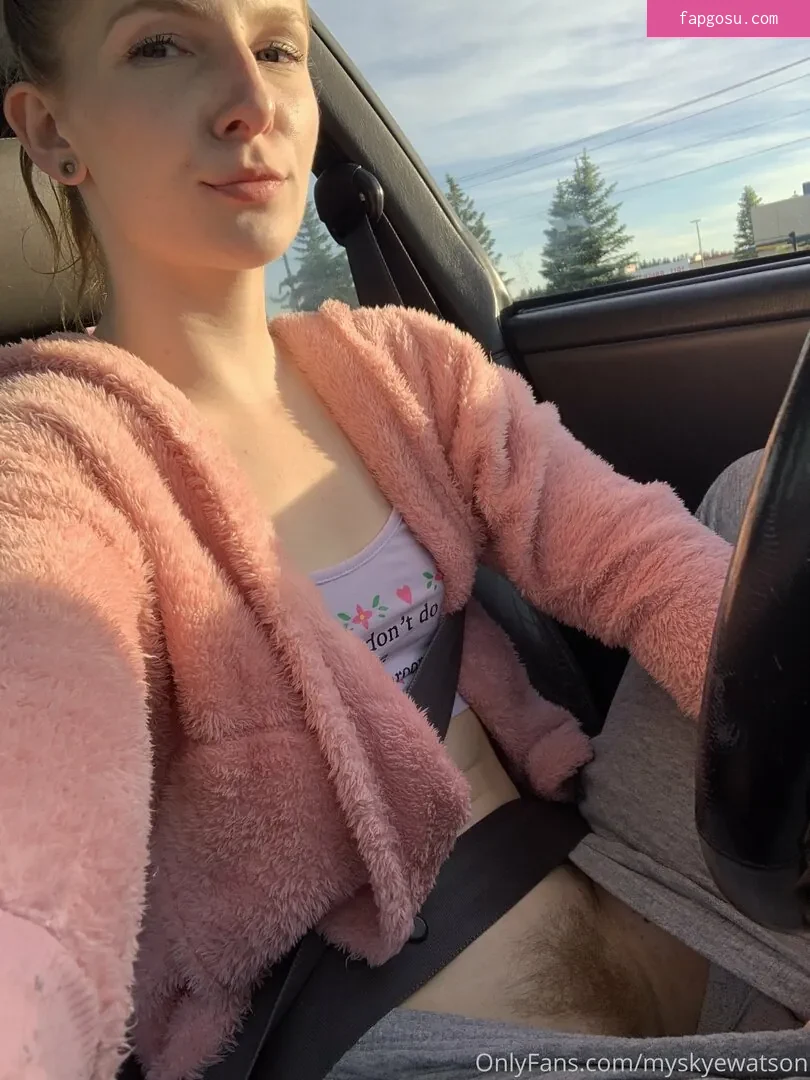 myskyewatson