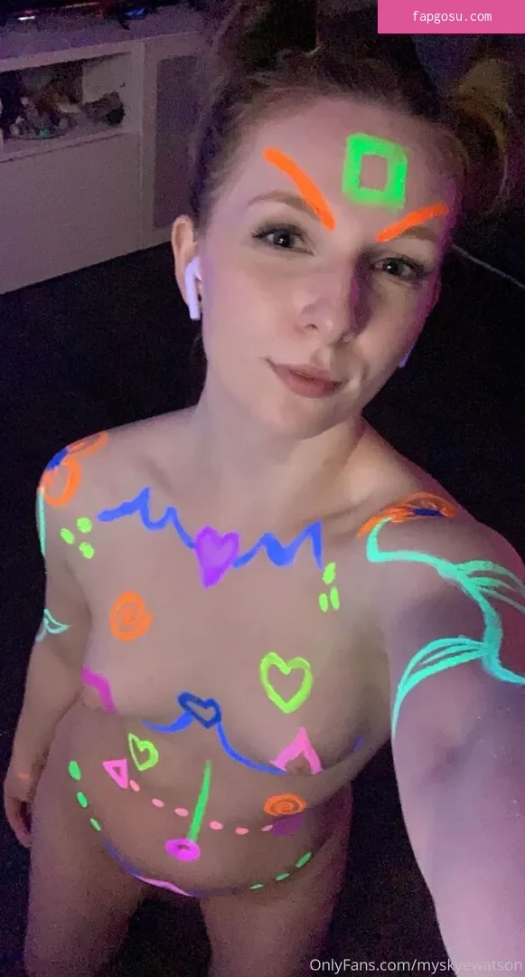 myskyewatson