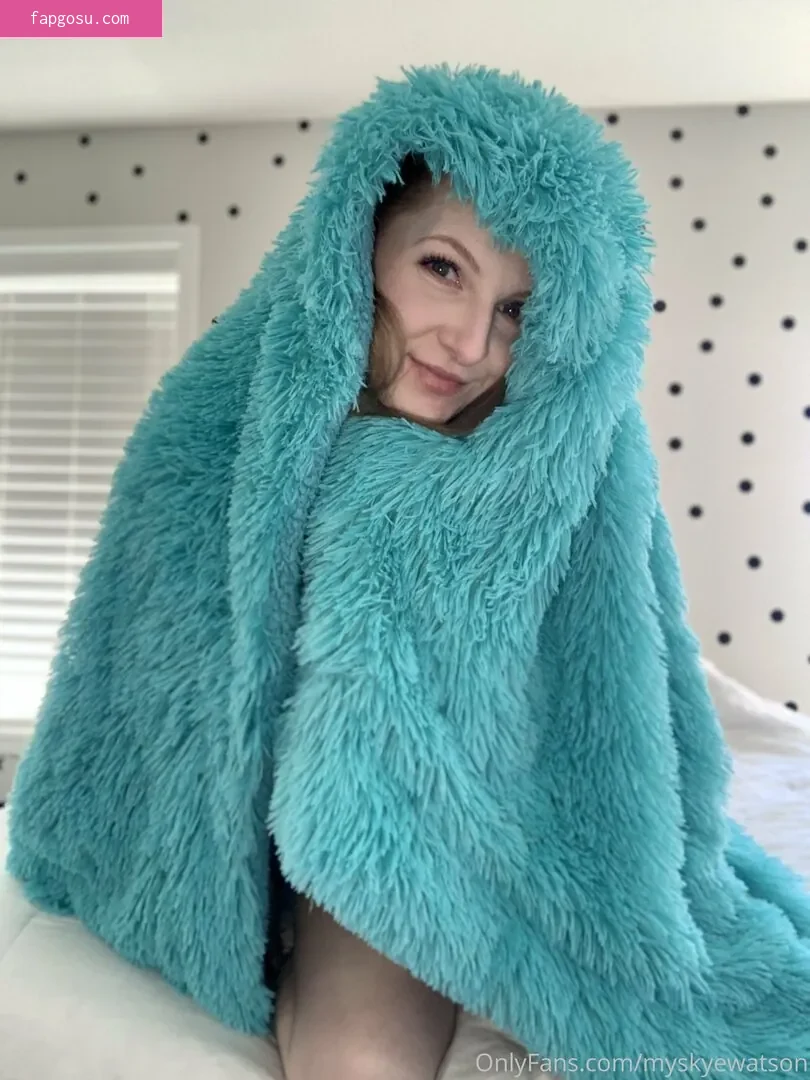 myskyewatson
