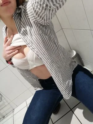 vitiligo95 content